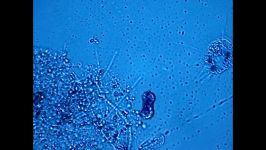 آزمایش علوم زیستچند میکروب مختلف در زیر میکروسکوپ
