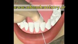 طریقه صحیح استفاده نخ دندان دندانپزشکی آبان