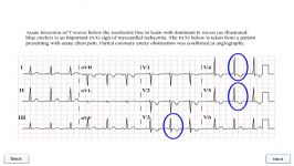 21 NSTEACS  Differential Section3 5