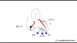 19 STEMI Localisation Section 3  Part 3