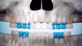 مراکز تخصصی ارتودنسی دکتر صدرالدینیمراحل رویش دندانها