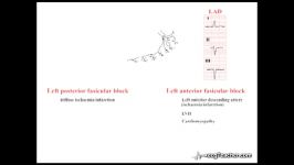 11 ‪ECGTeacher.com  Axis Deviation  Causes Section 2  Part 5‬