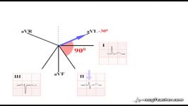 10 ECGTeacher.com  Axis Deviation  Recognition Section 2  Part 4