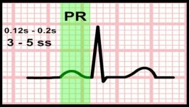 5 Time and the ECG Section 1  Part 5