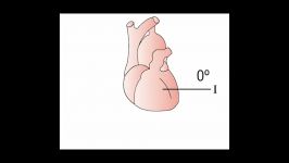 4   ECG Lead Perspectives Section 1  Part 4