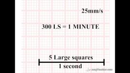 5 1 Time and the ECG Section 1.5  Part 1