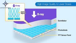 Konica Minolta Digital Radiography AeroDR Wireless FlatPanel