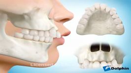 ارتودنسی کشیدن دندان  دکتر مسعود داودیان