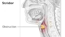 Abnormal Breath SOUNDS