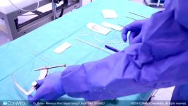 Dr. Maurice Balke  Meniscus Root Repair Using Y Knot® Flex