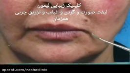 توضیحات باسابقه دارترین جراح زیبایی صورت در خصوص موثرترین روش جوانسازی صورت