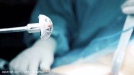 جراحی تعویض کامل مفصل لگن توسط دکتر علیرضا امین جواهری