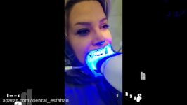 آفیس بلیچینگ بلیچینگ سفید کردن دندان در اصفهان در مطب دندانپزشکی اصفهان