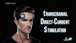 Can You Use Electricity to Supercharge Your Brain  tDCS