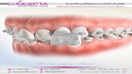 ارتودنسی دیمون  کلینیک کانسپتا