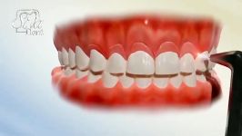 لبخند لثه ای  دندانپزشکی سیمادنت