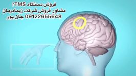 دستگاه آر تی ام اسrTMS.مشاور فروش09122655648مگنت،شاک ویو،تکارتراپی