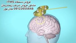 دستگاه آر تی ام اسrTMSمشاور فروش09122655648مگنت،شاک ویو درمانی،تکارتراپی