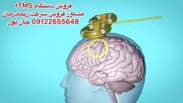 دستگاه آر تی ام اسrTMSمشاور فروش09122655648مگنت تراپی،شاک ویو،تکار