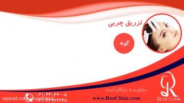 تزریق چربی  فیلم تزریق چربی  کلینیک پوست مو رز  شماره21