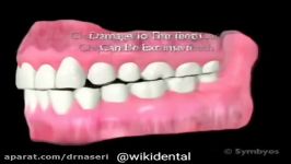 درمان دندان قروچه،متخصص ارتودنسی اصفهان دکتر محمد علی ناصری
