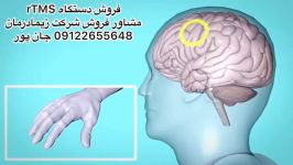 دستگاه تی ام اسTMSمشاور فروش09122655648شاک ویو،سی پی امcpm،لیزر