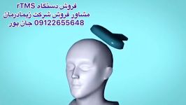 دستگاه تی ام اسTMSمشاور فروش09122655648سی پی امcpm،لیزر،مگنت