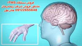 دستگاه تی ام اسTMSمشاور فروش09122655648سی پی امcpm،لیزر،ترکشن