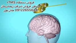 تی ام اس،مشاور فروش09122655648استیمولاتور اینترفرنشیال،فارادیک،تنس