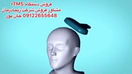 تی ام اس،مشاور فروش09122655648تحریک کننده فارادیک،تنس،دستگاه فیزیوتراپی