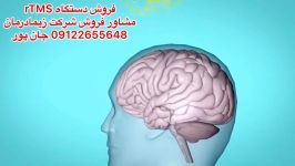 تی ام اس،مشاور فروش09122655648تحریک کننده فارادیک،تنس،If،دستگاه فیزیوتراپی