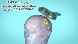 آر تی ام اس،مشاور فروش09122655648تحریک کننده فارادیک،تنس،If،دستگاه فیزیوتراپی