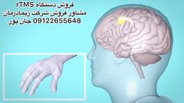 آر تی ام اس،مشاور فروش09122655648فارادیک،تنس،If،دستگاه فیزیوتراپی،توانبخشی