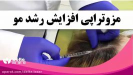 آیا ریزش مو دارید؟ موهاتون کم پشت شده ؟