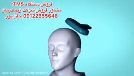 آر تی ام اس چیست.مشاور فروش09122655648ساخت اندام مصنوعیدست پای هوشمند تهران