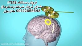 آر تی ام اس.مشاور فروش09122655648ارتوپدی فنی،آتل،قوزبند،زانوبند،کمربند،کفش طبی