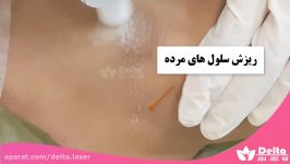 رفع تیرگی قوزک پا در چند دقیقه بدون درد 