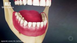 عوارض دست دادن دندان  دکتر لیلا عطایی