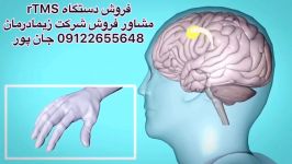 آر تی ام اس.فروش09122655648مرکز فیزیوتراپی،کایروپراکتیک در تهران.شمال،شرق،غرب