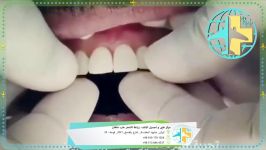 مرکز طب ماهان لکم الخدمات التجمیلیة التخصصیة والعلاج للأسنان