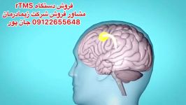 آر تی ام اس.مشاور فروش09122655648مرکز فیزیوتراپی،گفتار،کاردرمانی،ماساژ تهران