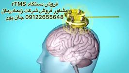 آر تی ام اس پزشکی،مشاوره فروش09122655648قیمت خرید انواع سمعک نامرئی تهران