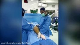 HIP replacement for fracture in amputated limb