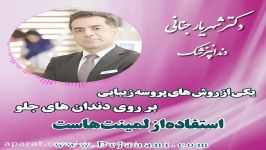 دندان هایتان را لمینت زیباتر کنید