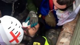 I will lose my eye Yellow Vest activist suffers horrific i