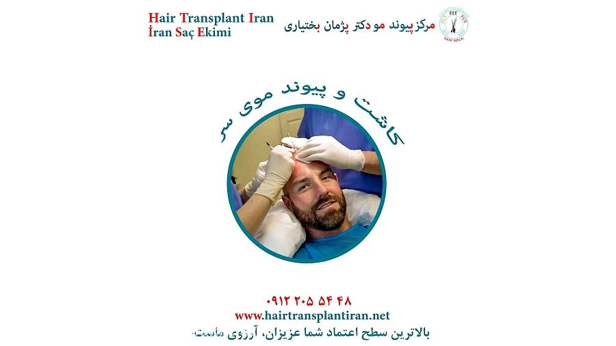 بهترین متخصص در کاشت مو طبیعی دکتر پژمان بختیاری