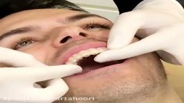 ارتودنسی نامرئی  دندانپزشکی پردیس 02188676014