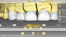 دندانپزشکی دیجیتال  دندانپزشکی پردیس 02188676014