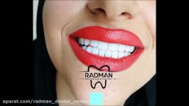 کلینیک دندانپزشکی زیبایی کرج رادمان