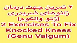 درمان پزشکی زانوی ضربدری09122655648فیزیوتراپی در منزل،مطب،بریس اصلاحی